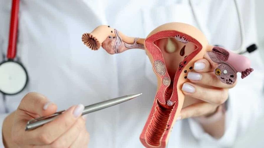 Una Nueva Prueba Para Detectar El Cáncer De útero Reduce La Mayoría De Falsos Positivos